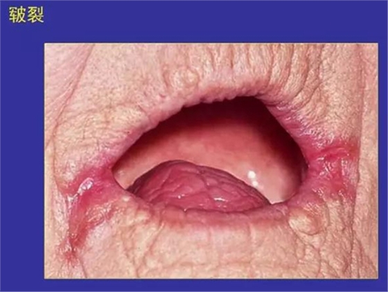 正?？谇火つぜ俺Ｒ姴p圖