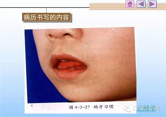 口腔正畸學(xué)病歷書寫 口腔正畸學(xué)病歷書寫