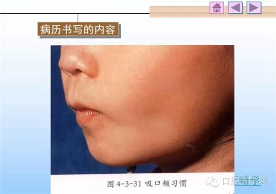 口腔正畸學(xué)病歷書寫 口腔正畸學(xué)病歷書寫