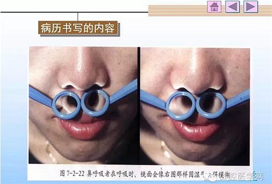 口腔正畸學(xué)病歷書寫 口腔正畸學(xué)病歷書寫