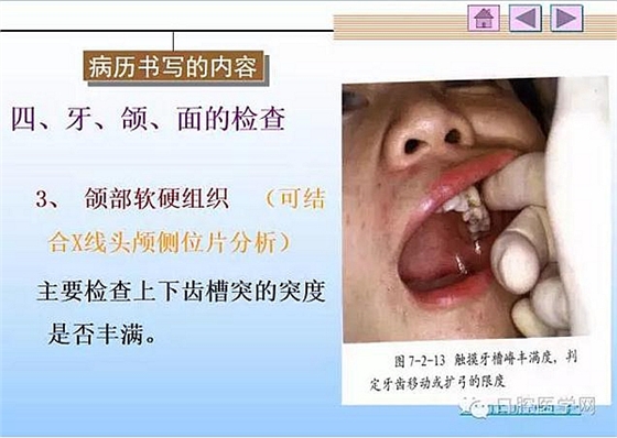 口腔正畸學(xué)病歷書寫 口腔正畸學(xué)病歷書寫