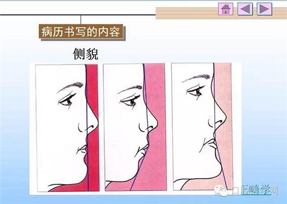 口腔正畸學(xué)病歷書寫 口腔正畸學(xué)病歷書寫