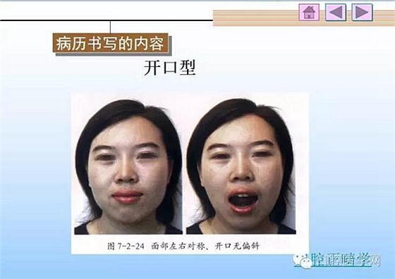 口腔正畸學(xué)病歷書寫 口腔正畸學(xué)病歷書寫