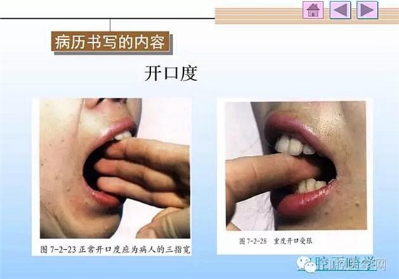 口腔正畸學(xué)病歷書寫 口腔正畸學(xué)病歷書寫