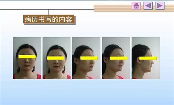 口腔正畸學(xué)病歷書寫 口腔正畸學(xué)病歷書寫