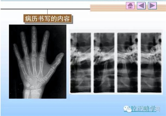 口腔正畸學(xué)病歷書寫 口腔正畸學(xué)病歷書寫