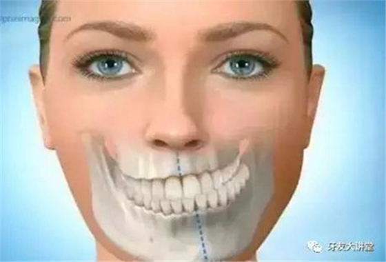 “發(fā)現(xiàn)即矯正”12歲前必須處理的20種兒童牙頜畸形 “發(fā)現(xiàn)即矯正”12歲前必須處理的20種兒童牙頜畸形