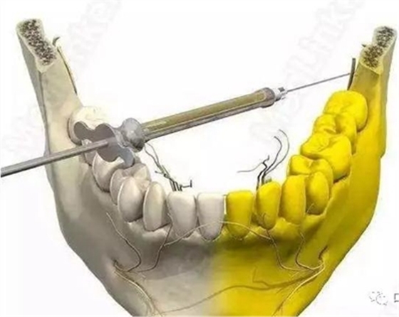 口腔科急救預(yù)案 口腔科急救預(yù)案