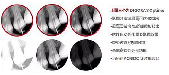 數(shù)字口內(nèi)影像板掃描處理系統(tǒng)-牙片寶 數(shù)字口內(nèi)影像板掃描處理系統(tǒng)-牙片寶