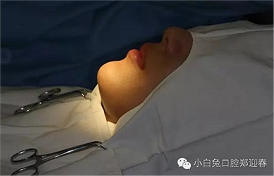 (原創(chuàng))//圖解微創(chuàng)舒適拔牙全過(guò)程 (原創(chuàng))//圖解微創(chuàng)舒適拔牙全過(guò)程