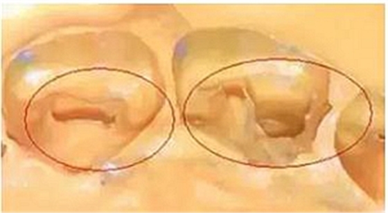 這10種情況下要重新取硅橡膠模型 這10種情況下要重新取硅橡膠模型