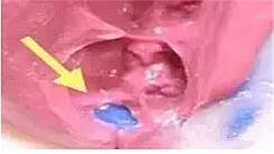 這10種情況下要重新取硅橡膠模型 這10種情況下要重新取硅橡膠模型