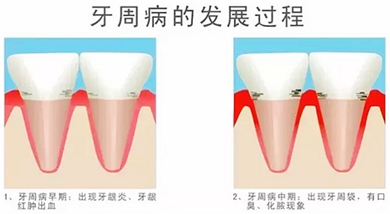 6IQ%~F3H9L2AUBED4{47M_1.png 6IQ%~F3H9L2AUBED4{47M_1.png