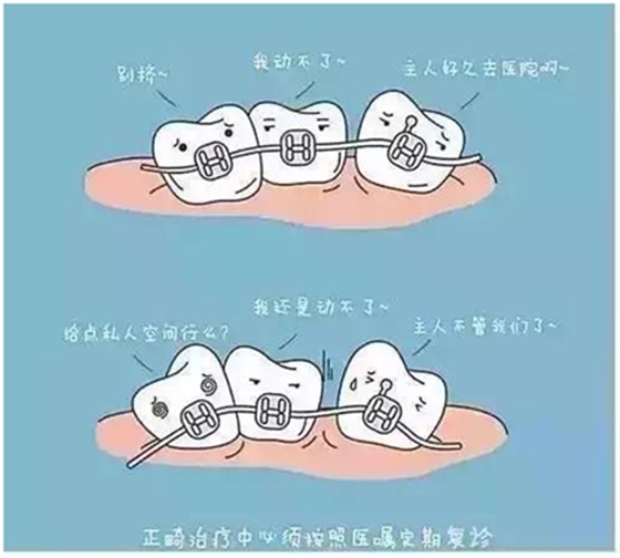 關于牙齒矯正，你想知道的都在這！