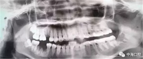 拔牙非小事，請(qǐng)不要拿成本衡量牙醫(yī)的價(jià)值！