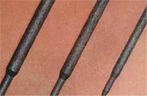 纖維樁修復(fù)之精細(xì)操作 纖維樁修復(fù)之精細(xì)操作