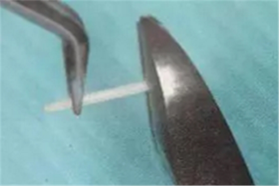 纖維樁修復(fù)之精細(xì)操作 纖維樁修復(fù)之精細(xì)操作