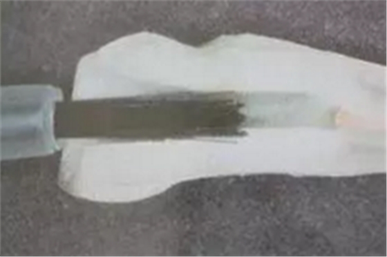 纖維樁修復(fù)之精細(xì)操作 纖維樁修復(fù)之精細(xì)操作