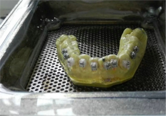 【原創(chuàng)博客】淺談間接粘托槽托槽的方法與技巧 【原創(chuàng)博客】淺談間接粘托槽托槽的方法與技巧