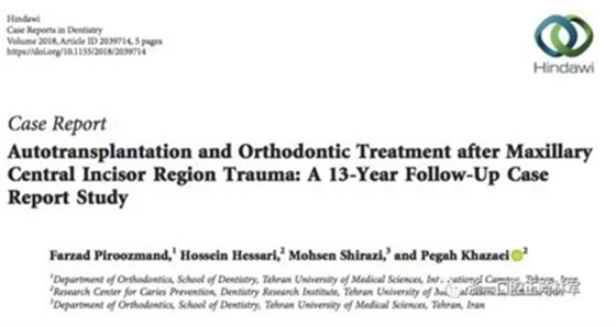 文獻優(yōu)秀正畸病例賞析--上頜中切牙區(qū)受傷后自體牙移植及正畸治療13年隨訪病例 文獻優(yōu)秀正畸病例賞析--上頜中切牙區(qū)受傷后自體牙移植及正畸治療13年隨訪病例