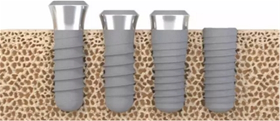 種植體，在全球牙科設(shè)備市場(chǎng)的變化！