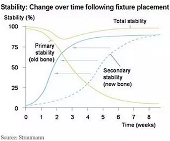 種植體，在全球牙科設(shè)備市場(chǎng)的變化！