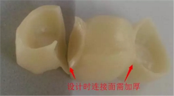 全鋯牙冠裂原因分析—操作流程工藝以及患者日常使用 全鋯牙冠裂原因分析—操作流程工藝以及患者日常使用