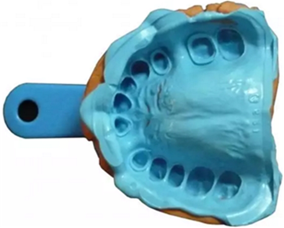 【分享】高水平義齒制作工藝流程 【分享】高水平義齒制作工藝流程