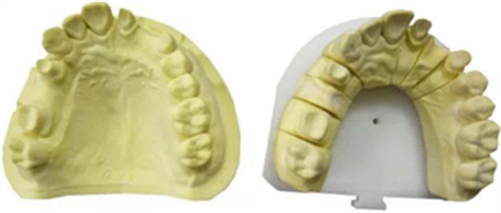 【分享】高水平義齒制作工藝流程 【分享】高水平義齒制作工藝流程