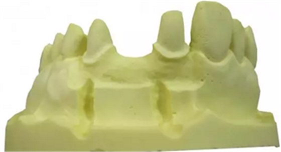 【分享】高水平義齒制作工藝流程 【分享】高水平義齒制作工藝流程