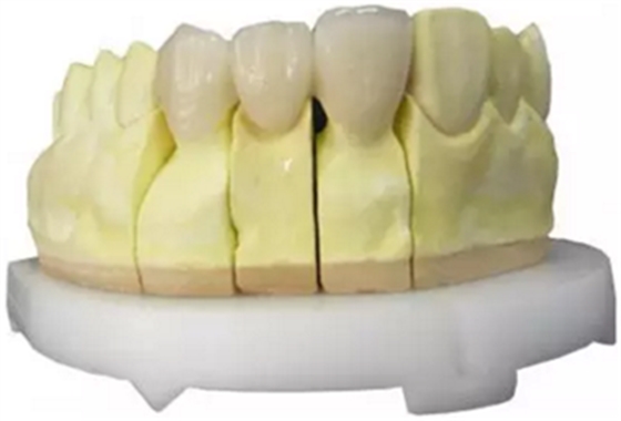 【分享】高水平義齒制作工藝流程 【分享】高水平義齒制作工藝流程