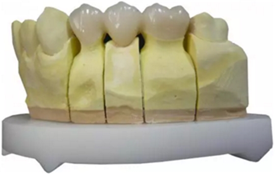 【分享】高水平義齒制作工藝流程 【分享】高水平義齒制作工藝流程