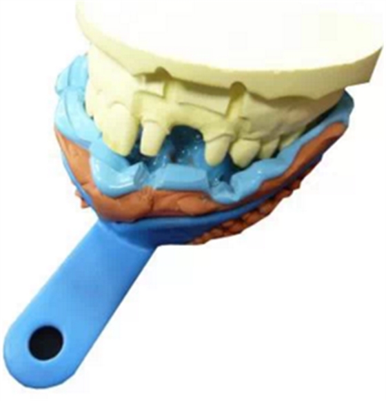 【分享】高水平義齒制作工藝流程 【分享】高水平義齒制作工藝流程