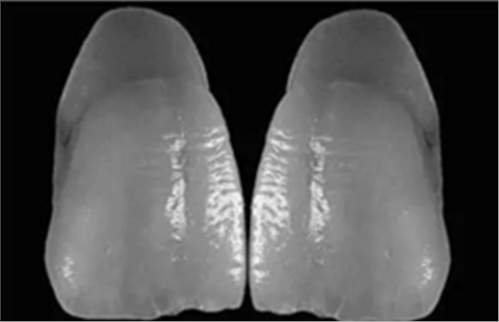 【分享】高水平義齒制作工藝流程 【分享】高水平義齒制作工藝流程