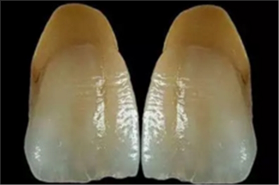 【分享】高水平義齒制作工藝流程 【分享】高水平義齒制作工藝流程