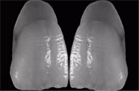 【分享】高水平義齒制作工藝流程 【分享】高水平義齒制作工藝流程