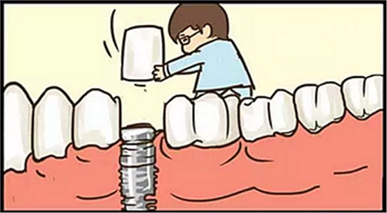 【牙齒種植】健康牙齒“種”出來(lái) 【牙齒種植】健康牙齒“種”出來(lái)