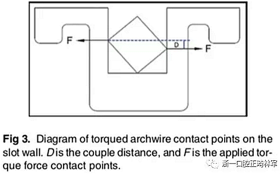 正畸文獻(xiàn)閱讀--不銹鋼托槽與鈦托槽形變差異的有限元分析 正畸文獻(xiàn)閱讀--不銹鋼托槽與鈦托槽形變差異的有限元分析