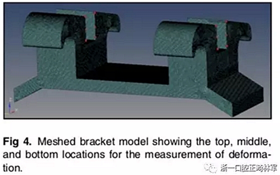 正畸文獻(xiàn)閱讀--不銹鋼托槽與鈦托槽形變差異的有限元分析 正畸文獻(xiàn)閱讀--不銹鋼托槽與鈦托槽形變差異的有限元分析