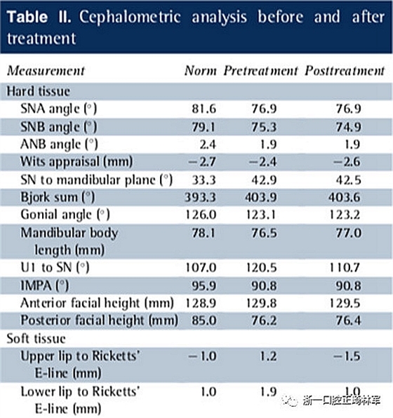文獻優(yōu)秀正畸病例賞析--多顆牙齒缺失的牙周炎患者的跨學科綜合治療 文獻優(yōu)秀正畸病例賞析--多顆牙齒缺失的牙周炎患者的跨學科綜合治療