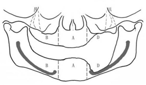 無牙頜種植修復的檢查與設計——施斌教授 無牙頜種植修復的檢查與設計——施斌教授