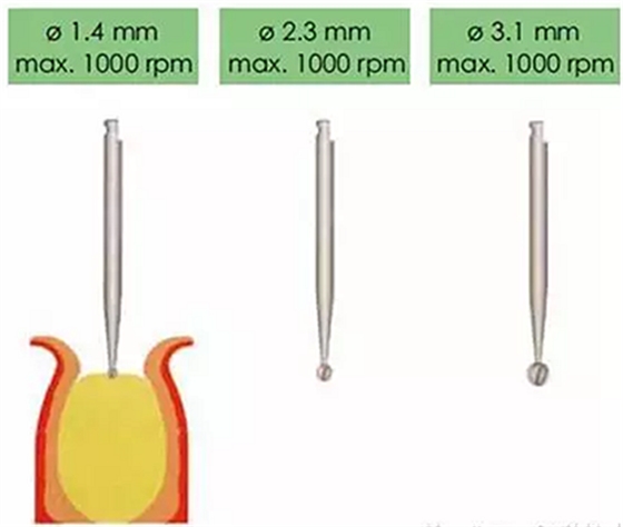 Sraumann種植系統(tǒng)外科操作流程 Sraumann種植系統(tǒng)外科操作流程