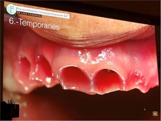 課堂筆記 | 看大師如何運(yùn)用數(shù)字化流程解決復(fù)雜病例