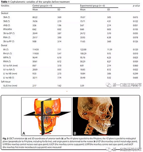 正畸文獻(xiàn)閱讀--用舌側(cè)滑動(dòng)牽引系統(tǒng)控制前牙區(qū)段:初步的CBCT研究 正畸文獻(xiàn)閱讀--用舌側(cè)滑動(dòng)牽引系統(tǒng)控制前牙區(qū)段:初步的CBCT研究