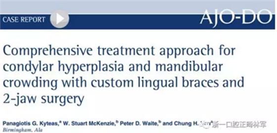 正畸文獻賞析--正頜外科學的相關研究 正畸文獻賞析--正頜外科學的相關研究