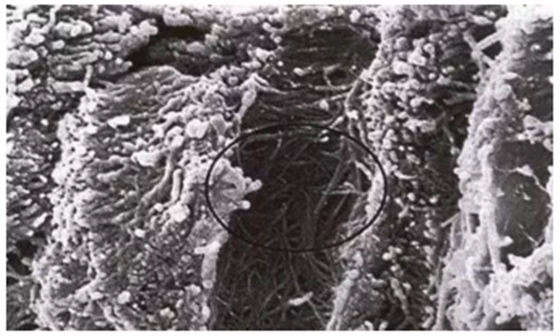 詳細(xì)了解自酸蝕、全酸蝕