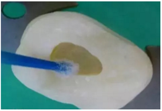 詳細(xì)了解自酸蝕、全酸蝕