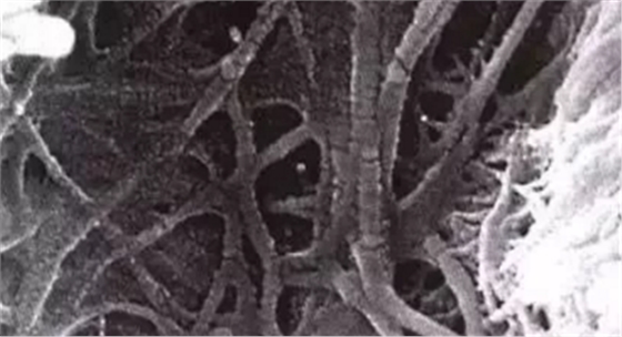 詳細(xì)了解自酸蝕、全酸蝕