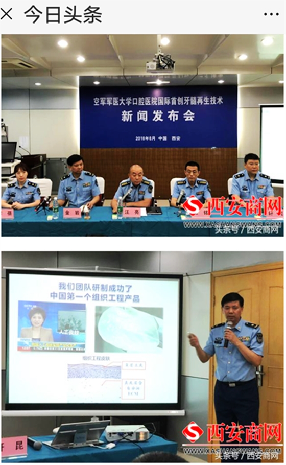 空軍軍醫(yī)大學(xué)口腔醫(yī)院首創(chuàng)牙髓再生術(shù) 空軍軍醫(yī)大學(xué)口腔醫(yī)院首創(chuàng)牙髓再生術(shù)