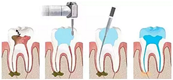 你總?cè)轮囱?ldquo;貴”還不是你自己造成的 你總?cè)轮囱?ldquo;貴”還不是你自己造成的